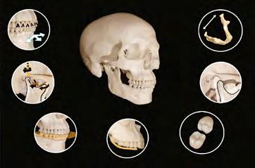 oclusal, a curvatura oclusal anteroposterior e a altura e angulação das cúspides dos dentes posteriores (Fig. 3-2-38).