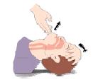 16 de 48 RESPIRAÇÃO ARTIFICIAL: Para intercalar cm as massagens cardíacas, a respiraçã artificial deve ser realizada da seguinte frma: 1.