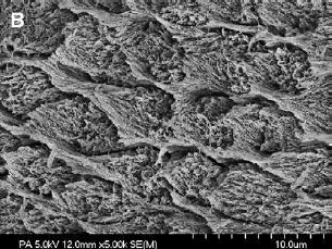 Estudo In Vitro da Resistência Adesiva por Microtração de Dois Sistemas Adesivos Universais realizados com o objetivo de melhorar a adesão entre a resina e a estrutura dentária (Perdigão et al.