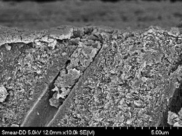 Estudo In Vitro da Resistência Adesiva por Microtração de Dois Sistemas Adesivos Universais Figura 3 - Imagem obtida por microscopia electrónica de varrimento da smear layer e smear plug na dentina