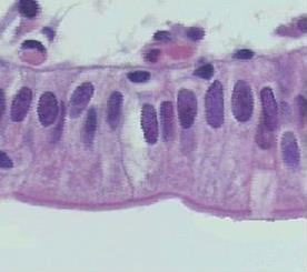 DIGESTÃO DOS CARBOIDRATOS NO INTESTINO DELGADO Lúmen