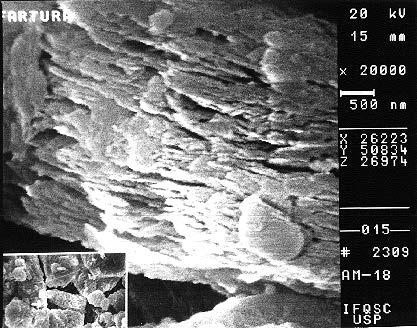 Anexo 2 - Fotografias no Microscópio Eletrônico de Varredura Observações: Notar a presença de caulinita não laterizada.
