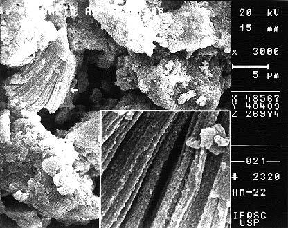 Anexo 2 - Fotografias no Microscópio Eletrônico de Varredura Observações: Notar a presença de caulinita não laterizada e/ou mica.