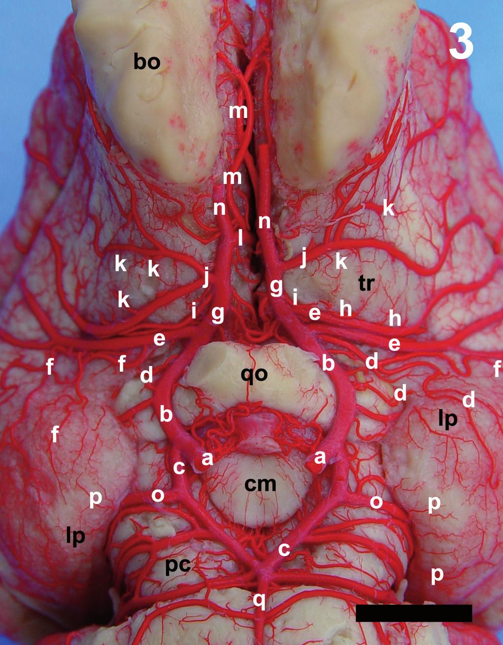 Figura 3. Fotografia em vista ventral (detalhe) da base do hemisfério cerebral salientando os ramos centrais das ramificações das artérias cerebrais, (Observação 10).
