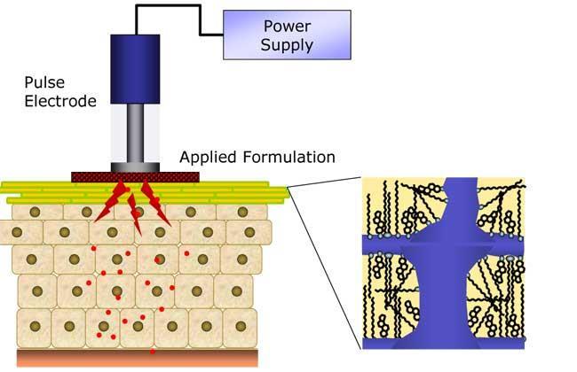 Eletroporação Aplicação de pulsos elétricos de alta voltagem