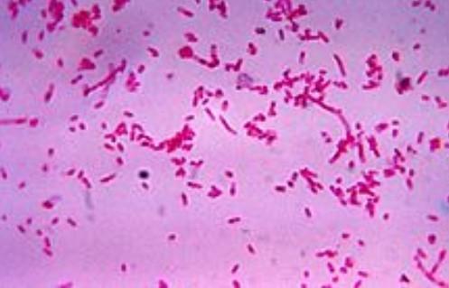 nosso corpo temos mais bactérias do que células!). Já ouviu falar sobre a flora intestinal?