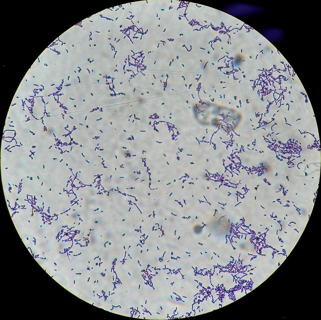 BACTÉRIAS É, praticamente em todos os lugares! Muitas bactérias habitam o SOLO, por exemplo, como essas no microscópio.