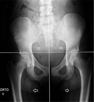 quadrantes com calcificações Figura