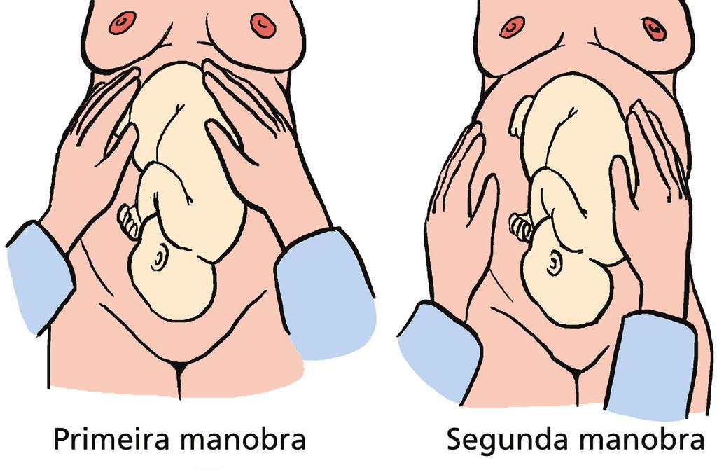 Segundo tempo: O feto pode estar em situação longitudinal ou transversa e pode estar em apresentação cefálica ou pélvica.