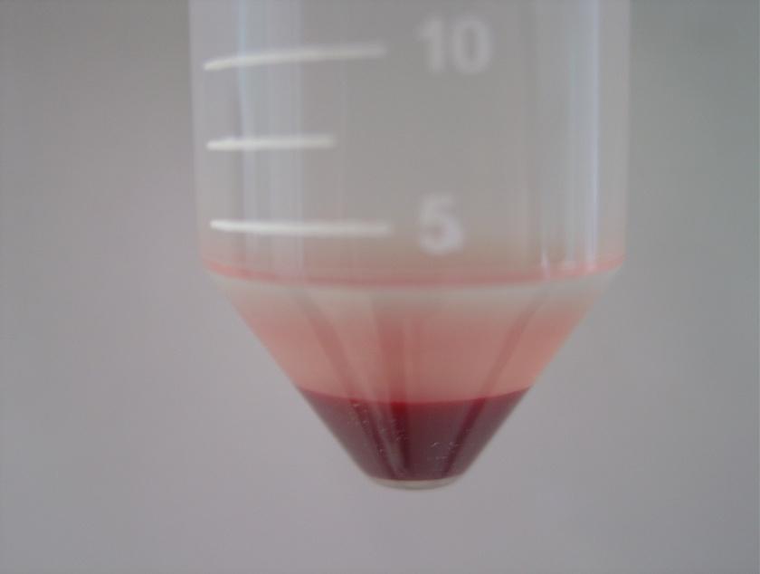 Em B evidenciamos a amostra sem ficoll, com formação de um pellet de células totais do sangue (asterisco) 4.5.