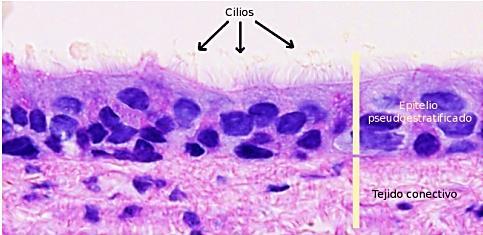 TIPOS DE TECIDO EPITELIAL EPITÉLIO PSEUDOESTRATIFICADO: Formado por apenas uma camada de células cujos núcleos estão em