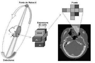 31 2.2 Considerações Gerais A Tomografia Computadorizada é uma técnica na qual o processamento digital de projeções pode ser usado para gerar uma imagem em três dimensões das regiões de interesse.