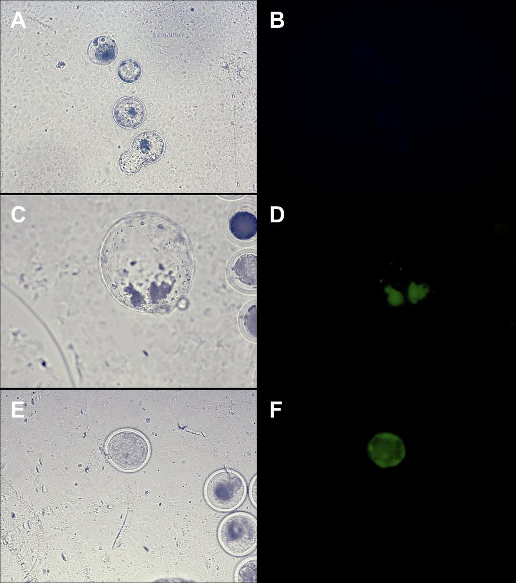 64 Figura 19 Fotografias dos embriões produzidos in vitro após protocolo de TGME.