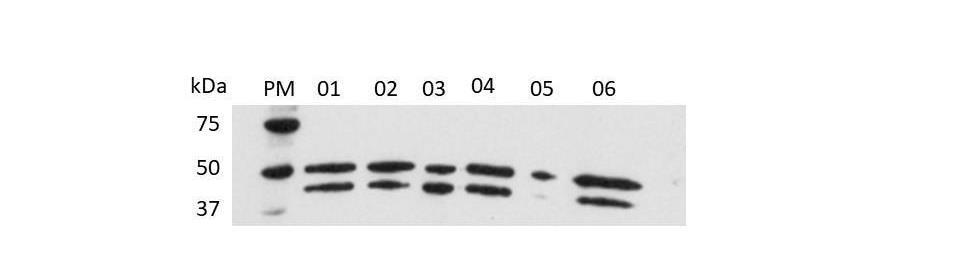 34 Figura 10: Detecção por immunoblotting das novas proteínas PvAMA-1.