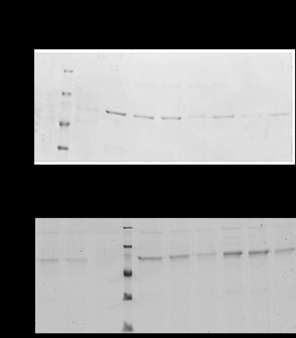 70 Figura suplementar 2: Estabelecimento das condições de indução (metanol) para otimização da expressão das novas proteínas PvAMA-1.