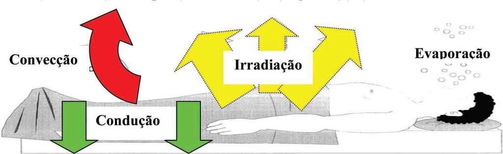 17 Figura 3 - Mecanismos de perda de calor no peri-operatório Fonte: Souza; Costa, (2006) A transferência de calor por condução depende da diferença de temperatura entre dois objetos em contato e da