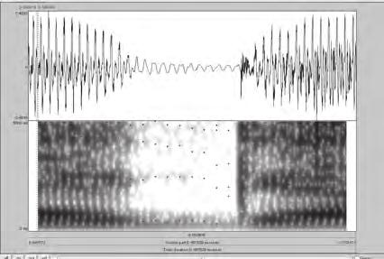 Deficiência de audição e contraste de vozeamento em oclusivas do português brasileiro: análise acústica e perceptiva Diga gata baixinho repetição 6, S1 Diga cata baixinho 6, S1 Figura 2 Forma da onda