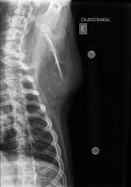 Figura 4 - Projeção caudo-cranial com maior aumento de volumes nas partes moles da escápula em comparação ao exame radiográfico anterior. A radiografia de tórax não revelou presença de metástase.