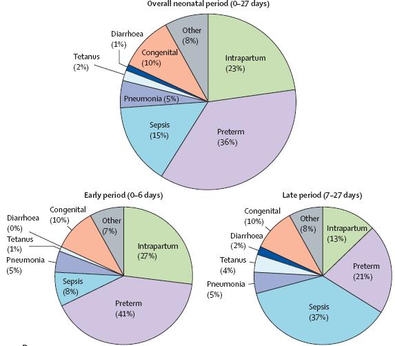 16 Figura 4 - Principais causas de óbitos neonatais no mundo. Fonte: Lawn et al., 2014 1.2.1 Mortalidade neonatal no Brasil Na estimativa de Wang et al.