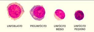 7 Figura 2- processo de multiplicação e diferenciação progressiva até o estágio de linfócito maduro Fonte: (PALMER, et al., 2015). Figura 3- amostra de sangue periférico com presença de linfócitos.