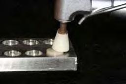 O polimento dos cdp foi dado primeiramente com as taças siliconadas do tipo Enhance (Dentsply Ind.e Com.