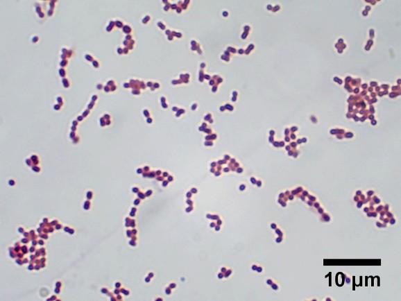 32 6 RESULTADOS E DISCUSSÃO 6.1 Caracterização do isolado FIL01 As Figuras 1 e 2 mostram o resultado dos testes utilizados para caracterizar a cepa FIL01 isolada do leite fermentado Filmjölk.