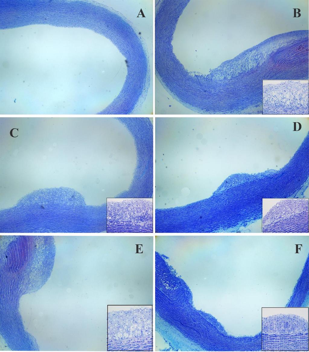 Fotomicrografias representativas de corte histológico do tecido aórtico de coelhos Tempo de experimento 50 dias. A. Dieta padrão (G1); B. Dieta hipercolesterolemiante (G2); C.