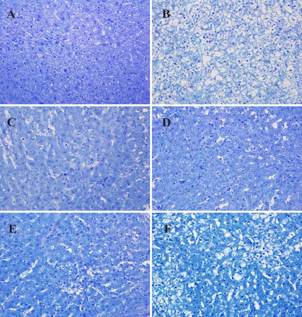 Fotomicrografias representativas de corte histológico do tecido hepático de coelhos Tempo de experimento 50 dias. A. Dieta padrão (G1); B. Dieta hipercolesterolemiante (G2); C.