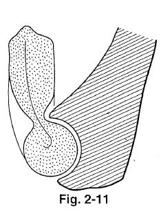 A cabeça do rádio articula-se com a incisura radial da ulna e é mantida na posição pelo ligamento anular. 3.