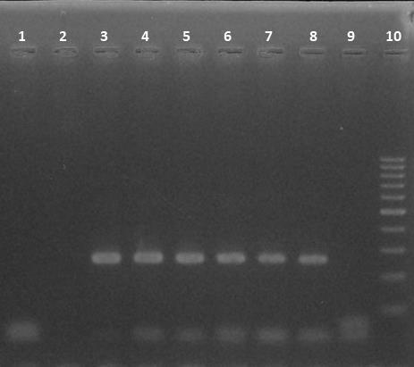 50 Figura 2- sensibilidade analítica da reação de Nested-PCR empregando os primers 517F22 e 755R24 utilizando diferentes concentrações de DNA de B. canis (cepa RM6/66).