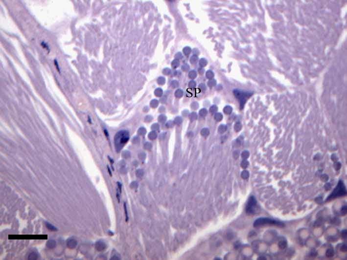 Bainha peritoneal (BP), células em diferentes estágios de
