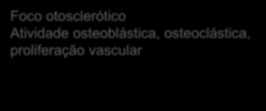proliferação vascular Figura 2: Histopatología da otosclerose.