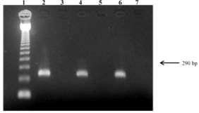 BVDV : Diagnóstico laboratorial Detecção de vírus: Métodos rápidos Elisa para detecção de Ag: triagem do rebanho Imunohistoquímica: detecção do vírus em tecidos