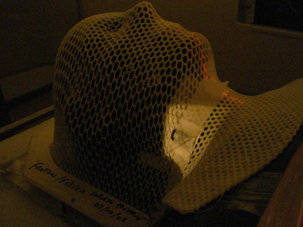 Figura 3.10. Detector OSL colocado na máscara imobilizadora. 3.7 O planejamento da dose a ser administrada Para o cálculo da dose de irradiação a ser administrada, foi utilizado o sistema de planejamento computadorizado Eclipse, versão 8.