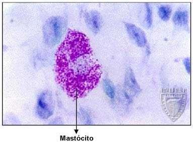 MASTÓCITO: Célula globosa ou