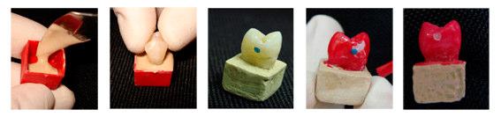 um modelo de encaixe, empregando uma caixa de plástico no tamanho 1 x 1 x 1cm, na qual os dentes foram incluídos com a porção radicular ficando coberta por gesso pedra Herodent (Vigodent S.A.