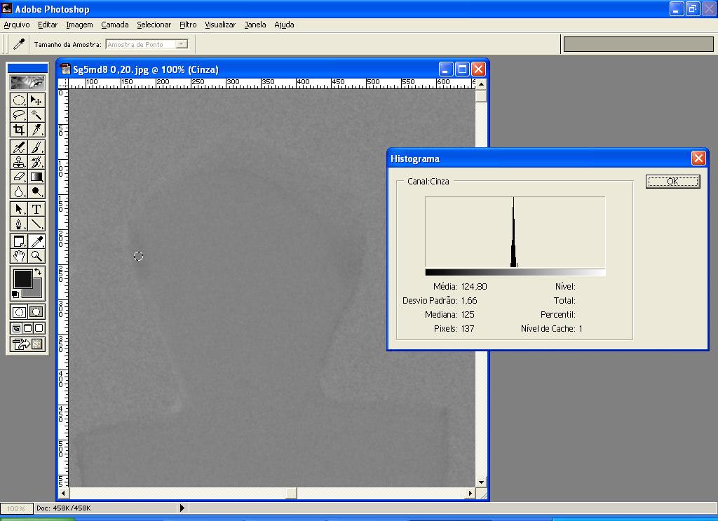 3.6.1 Avaliação Quantitativa das Imagens Subtraídas As imagens de subtração foram avaliadas quantitativamente em uma área padronizada no esmalte proximal (mesial e distal) e outra, controle, em