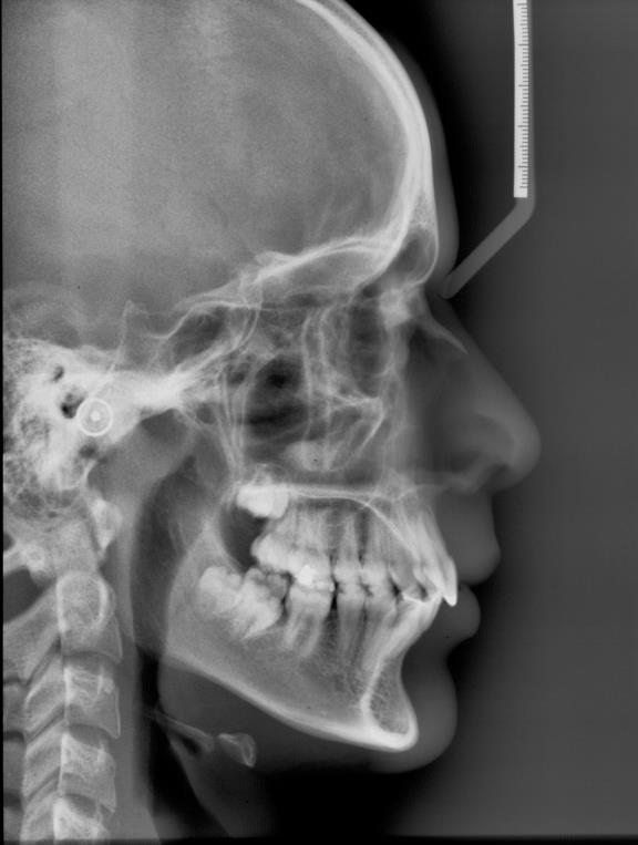 Figura 11-Radiografia teler