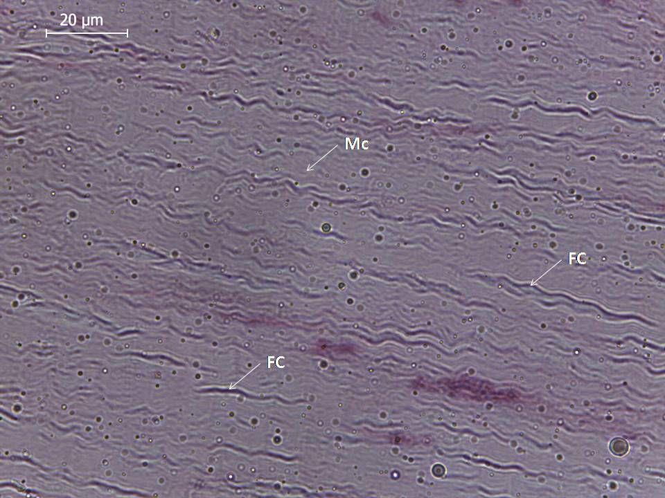 Cartilagem fibrosa Ocorre associada a algumas articulações, pontos onde tendões e