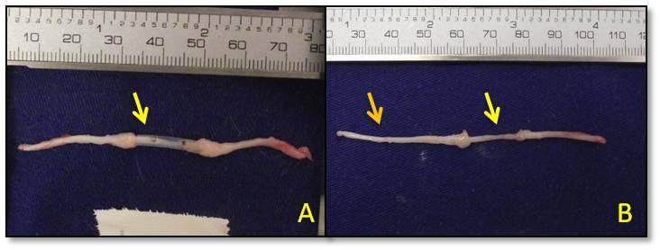 52 RESULTADOS O procedimento cirúrgico foi realizado sem intercorrências em todos os animais e a técnica de tubulização foi considerada de fácil exequibilidade.