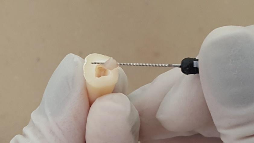 22 polpas dentárias foram submetidas a três processos de lavagem em centrífuga (DJB Labcare LTD., Buckinghamshire, Inglaterra), a 210G por 2min.