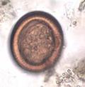 Morfologia Ovo (Forma infectante para o homem) É microscópico e esférico Possui uma membrana externa (embrióforo)