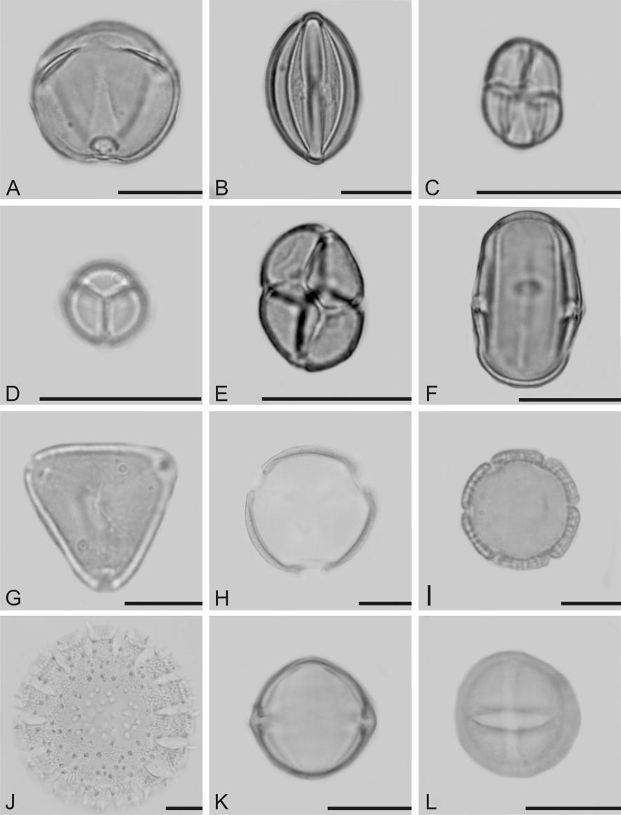 20 Figure 3. Photomicrographs of some pollen types found in Melipona asilvai pollen samples from Caatinga vegetation, Brazil. Fabaceae: A-B. Chamaecrista racemosa. C. Mimosa arenosa. D. Mimosa pudica.