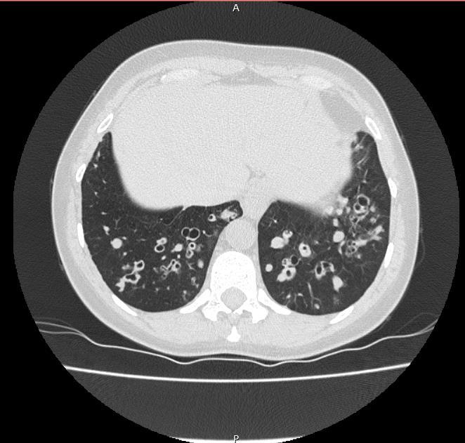 para melhorar o clearance mucociliar devem ser realizadas e ensinadas para todos os pacientes