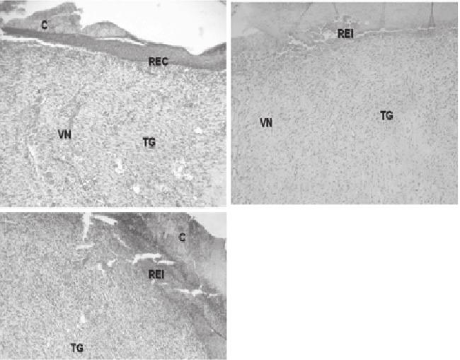ACTA SCIENTIA BIOLÓGICAS Figura 9 - Fotomicrografias de cortes de pele mostrando em A (tratamento com pasta de figo), B (tratamento com dersani) e C (tratamento com soro 0,9%) crosta