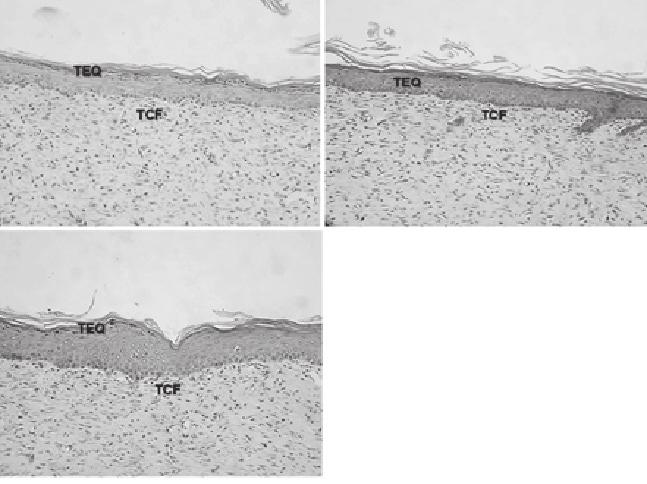 ACTA SCIENTIA BIOLÓGICAS Figura 17 - Fotomicrografias de cortes da pele mostrando em A (tratamento pasta de figo), B (tratamento dersani) e C (tratamento soro 0,9%) tecido epitelial queratinizado