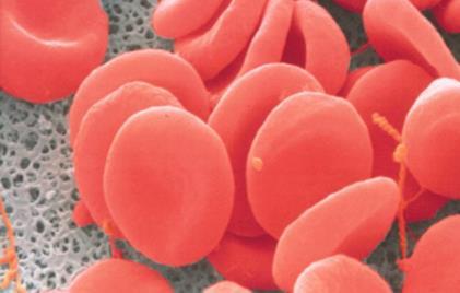Hemoglobina & Anemia Falciforme eritrócitos