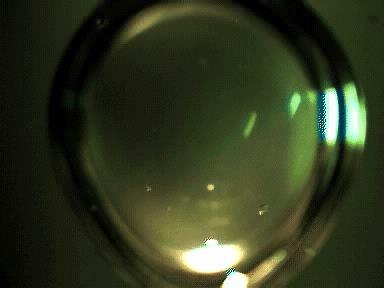 Formação de cristal de lisozima gotícula com cerca de 10 μl contendo solução de proteína + precipitantes, vista sob um microscópio tempo real do filme ~ 36 h; os cristais crescem em até ~ 18 h 65