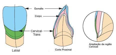 Cervical Trans A porcelana Cervical Trans foi projetada para