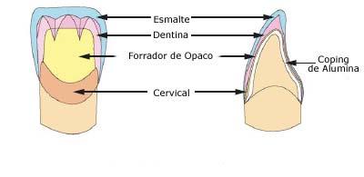 Tabela 2 Cores para Dentes Clareados Cor W1 W2 W3 Forrador Opaco W1O W2O W3O Cervical - - - Corpo W1B W2B W3B Opal 56 56:2 / 57:1 56:1 / 57:2 Tabela 3 Dentina Opaca Cor 1 2 3 3,5 4 root A OD-N OD-N:1